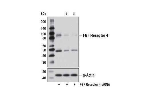 Western blot analysis of extracts from Huh7 cells, transfected with 100 nM SignalSilence ® Control siRNA (Unconjugated) #6568 (-), SignalSilence ® FGF Receptor 4 siRNA I #12472 (+), or SignalSilence ® FGF Receptor 4 siRNA II, using FGF Receptor 4 (D3B12) XP ® Rabbit mAb #8562 (upper) or β-Actin (D6A8) Rabbit mAb #8457 (lower). The FGF Receptor 4 (D3B12) XP ® Rabbit mAb confirms silencing of FGF Receptor 4 expression, while the β-Actin (D6A8) Rabbit mAb is used as a loading control.