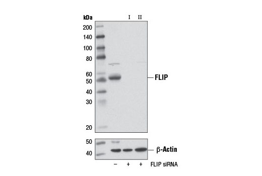 Western blot analysis of extracts from A549 cells, transfected with 100 nM SignalSilence ® Control siRNA (Unconjugated) #6568 (-), SignalSilence ® FLIP siRNA I (+), or SignalSilence ® FLIP siRNA II #12407 (+), using FLIP (D16A8) Rabbit mAb #8510 (upper) or β-Actin (D6A8) Rabbit mAb #8457 (lower). The FLIP (D16A8) Rabbit mAb confirms silencing of FLIP expression, while the β-Actin (D6A8) Rabbit mAb is used as a loading control.