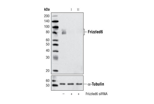 Western blot analysis of extracts from HeLa cells, transfected with 100 nM SignalSilence ® Control siRNA (Unconjugated) #6568 (-), SignalSilence ® Frizzled6 siRNA I #6596 (+) or SignalSilence ® Frizzled6 siRNA II (+), using Frizzled6 (D16E5) Rabbit mAb #5158 (upper) or α-Tubulin (11H10) Rabbit mAb #2125 (lower). The Frizzled6 (D16E5) Rabbit mAb confirms silencing of Frizzled6 expression, while the α-Tubulin (11H10) Rabbit mAb is used as a loading control.