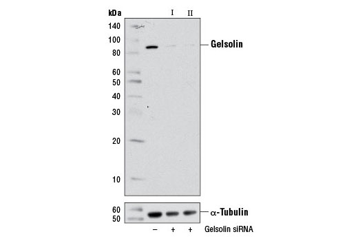 Western blot analysis of extracts from HeLa cells, transfected with 100 nM SignalSilence ® Control siRNA (Unconjugated) #6568 (-), SignalSilence ® Gelsolin siRNA I #6469 (+), or SignalSilence ® Gelsolin siRNA II (+), using Gelsolin Antibody #8090 (upper) or α-Tubulin (11H10) Rabbit mAb #2125 (lower). The Gelsolin Antibody confirms silencing of gelsolin expression, while the α-Tubulin (11H10) Rabbit mAb is used as a loading control.