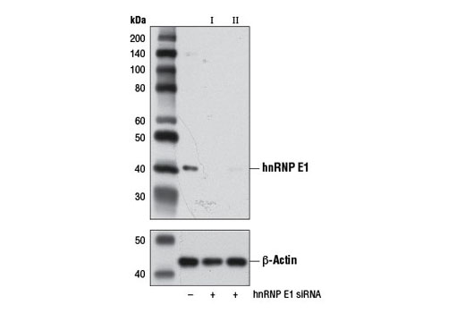 Western blot analysis of extracts from HeLa cells, transfected with 100 nM SignalSilence ® Control siRNA (Unconjugated) #6568 (-), SignalSilence ® hnRNP E1 siRNA I #7798 (+) or SignalSilence ® hnRNP E1 siRNA II (+), using hnRNP E1 Antibody #8534 (upper) and β-Actin (D6A8) Rabbit mAb #8457 (lower). The hnRNP E1 Antibody confirms silencing of hnRNP E1 expression, while the β-Actin (D6A8) Rabbit mAb is used as a loading control.