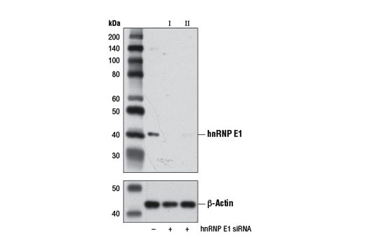 Western blot analysis of extracts from HeLa cells, transfected with 100 nM SignalSilence ® Control siRNA (Unconjugated) #6568 (-), SignalSilence ® hnRNP E1 siRNA I (+) or SignalSilence ® hnRNP E1 siRNA II #7987 (+), using hnRNP E1 Antibody #8534 (upper) or β-Actin (D6A8) Rabbit mAb #8457 (lower). The hnRNP E1 Antibody confirms silencing of hnRNP E1 expression, while the β-Actin (D6A8) Rabbit mAb is used as a loading control.
