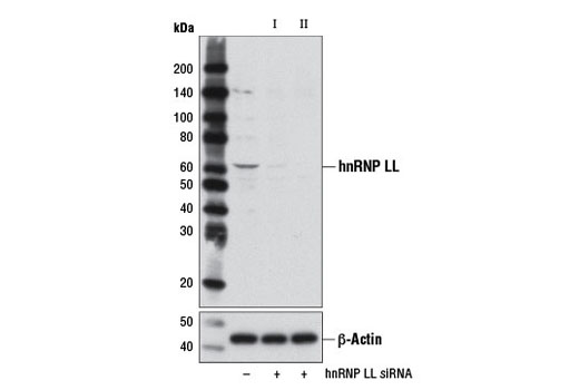 Western blot analysis of extracts from HeLa cells, transfected with 100 nM SignalSilence ® Control siRNA (Unconjugated) #6568 (-), SignalSilence ® hnRNP LL siRNA I (+), or SignalSilence ® hnRNP LL siRNA II #8624 (+), using hnRNP LL Antibody #4783 (upper) or β-Actin (D6A8) Rabbit mAb #8457 (lower). The hnRNP LL Antibody confirms silencing of hnRNP LL expression, while the β-Actin (D6A8) Rabbit mAb is used as a loading control.