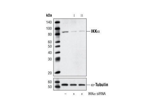 Western blot analysis of extracts from HeLa cells, transfected with 100 nM SignalSilence ® Control siRNA (Unconjugated) #6568 (-), SignalSilence ® IKKα siRNA I #6372 (+) or SignalSilence ® IKKα siRNA II (+), using IKKα Antibody #2682 (upper) or α-Tubulin (11H10) Rabbit mAb #2125 (lower). The IKKα Antibody confirms silencing of IKKα expression, while the α-Tubulin (11H10) Rabbit mAb is used as a loading control.