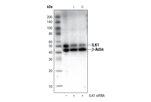 Western blot analysis of extracts from HeLa cells, transfected with 100 nM SignalSilence ® Control siRNA (Fluorescein Conjugate) #6201 (-) or SignalSilence ® ILK1 siRNA I #6202 or SignalSilence ® ILK1 siRNA II (+), using ILK1 (4G9) Rabbit mAb #3856 and β-Actin Antibody #4967. ILK1 (4G9) Rabbit mAb confirms silencing of ILK1 expression and β-Actin Antibody is used to control for loading and specificity of ILK1 siRNA.