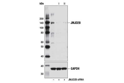 Western blot analysis of extracts from 293T cells, transfected with 100 nM SignalSilence ® Control siRNA (Unconjugated) #6568 (-), SignalSilence ® JMJD2B siRNA I (+), or SignalSilence ® JMJD2B siRNA II #7062 (+), using JMJD2B (D7E6) Rabbit mAb #8639 (upper) or GAPDH (D16H11) XP ® Rabbit mAb #5174 (lower). The JMJD2B (D7E6) Rabbit mAb confirms silencing of JMJD2B expression, while the GAPDH (D16H11) XP ® Rabbit mAb is used as a loading control.