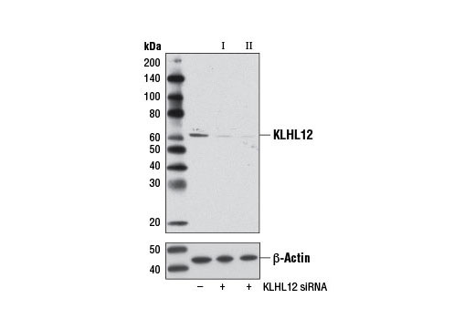Western blot analysis of extracts from 293T cells, transfected with 100 nM SignalSilence ® Control siRNA (Unconjugated) #6568 (-), SignalSilence ® KLHL12 siRNA I (+), or SignalSilence ® KLHL12 siRNA II #9420 (+), using KLHL12 (2G2) Mouse mAb #9406 (upper) or β-Actin (D6A8) Rabbit mAb #8457 (lower). The KLHL12 (2G2) Mouse mAb confirms silencing of KLHL12 expression, while the β-Actin (D6A8) Rabbit mAb is used as a loading control.