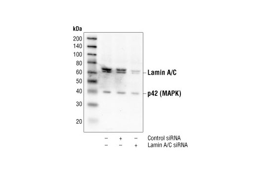 Western blot analysis of extracts from HeLa cells 48 hours following mock transfection, transfection with non-targeted (control) siRNA or transfected with Lamin A/C siRNA. Lamin A/C was detected using Lamin A/C Antibody #2032, and p42 MAPK was detected using p42 MAPK Antibody #9108. Lamin A/C Antibody confirms silencing of Lamin A/C expression, and the p42 MAPK Antibody is used to control for protein loading and siRNA specificity.