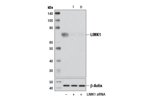 Western blot analysis of extracts from 293T cells, transfected with 100 nM SignalSilence ® Control siRNA (Unconjugated) #6568 (-), SignalSilence ® LIMK1 siRNA I #4559 (+), or SignalSilence ® LIMK1 siRNA II (+), using LIMK1 Antibody #3842 (upper) or β-Actin (D6A8) Rabbit mAb #8457 (lower). The LIMK1 Antibody confirms silencing of LIMK1 expression, while the β-Actin (D6A8) Rabbit mAb is used as a loading control.