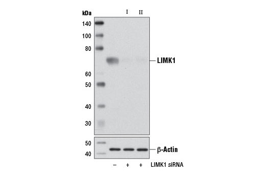 Western blot analysis of extracts from 293T cells, transfected with 100 nM SignalSilence ® Control siRNA (Unconjugated) #6568 (-), SignalSilence ® LIMK1 siRNA I (+), or SignalSilence ® LIMK1 siRNA II #7156 (+), using LIMK1 Antibody #3842 (upper) or β-Actin (D6A8) Rabbit mAb #8457 (lower). The LIMK1 Antibody confirms silencing of LIMK1 expression, while the β-Actin (D6A8) Rabbit mAb is used as a loading control.