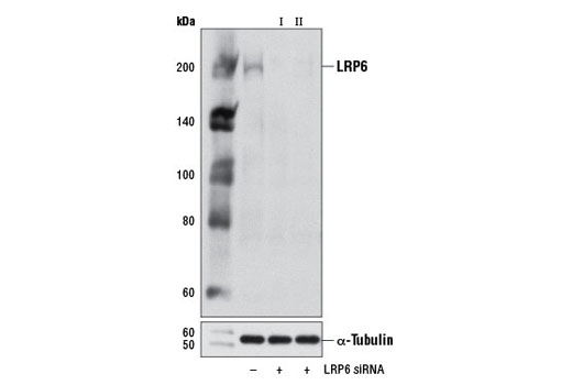Western blot analysis of extracts from 293 cells, transfected with 100 nM SignalSilence ® Control siRNA (Unconjugated) #6568 (-), SignalSilence ® LRP6 siRNA I #8650 (+) or SignalSilence ® LRP6 siRNA II (+), using LRP6 (C5C7) Rabbit mAb #2560 (upper) or α-Tubulin (11H10) Rabbit mAb #2125 (lower). The LRP6 (C5C7) Rabbit mAb confirms silencing of LRP6 expression, while the α-Tubulin (11H10) Rabbit mAb is used as a loading control.
