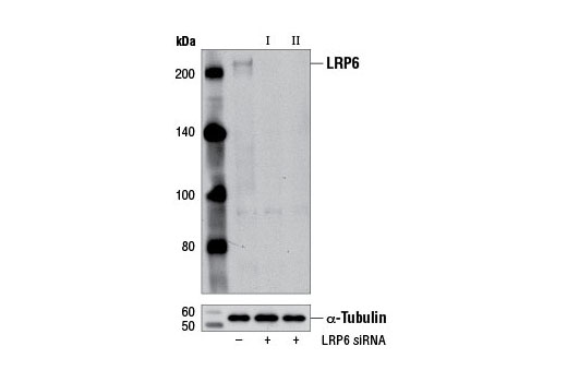 Western blot analysis of extracts from C2C12 cells, transfected with 100 nM SignalSilence ® Control siRNA (Unconjugated) #6568 (-), SignalSilence ® LRP6 siRNA I (Mouse Specific) #9834 (+) or SignalSilence ® LRP6 siRNA II (Mouse Specific) (+), using LRP6 (C47E12) Rabbit mAb #3395 (upper) or α-Tubulin (11H10) Rabbit mAb #2125 (lower). The LRP6 (C47E12) Rabbit mAb confirms silencing of LRP6 expression, while the α-Tubulin (11H10) Rabbit mAb is used as a loading control.
