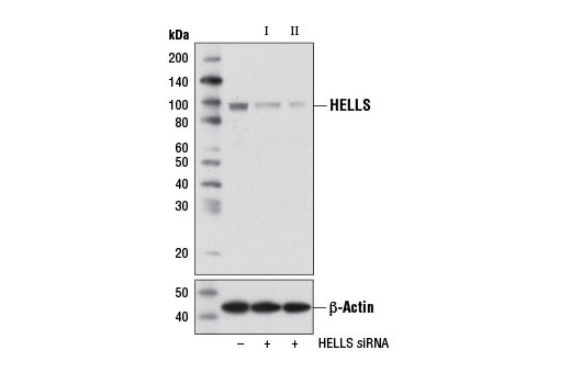 Western blot analysis of extracts from DLD-1 cells, transfected with 100 nM SignalSilence ® Control siRNA (Unconjugated) #6568 (-), SignalSilence ® HELLS siRNA I #11822 (+), or SignalSilence ® HELLS siRNA II (+), using HELLS Antibody #7998 (upper) or β-Actin (D6A8) Rabbit mAb #8457 (lower). The HELLS Antibody confirms silencing of HELLS expression, while the β-Actin (D6A8) Rabbit mAb is used as a loading control.