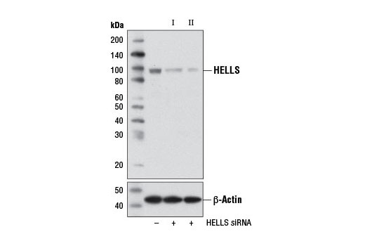 Western blot analysis of extracts from DLD-1 cells, transfected with 100 nM SignalSilence ® Control siRNA (Unconjugated) #6568 (-), SignalSilence ® HELLS siRNA I (+), or SignalSilence ® HELLS siRNA II #11823 (+), using HELLS Antibody #7998 (upper) or β-Actin (D6A8) Rabbit mAb #8457 (lower). The HELLS Antibody confirms silencing of HELLS expression, while the β-Actin (D6A8) Rabbit mAb is used as a loading control.