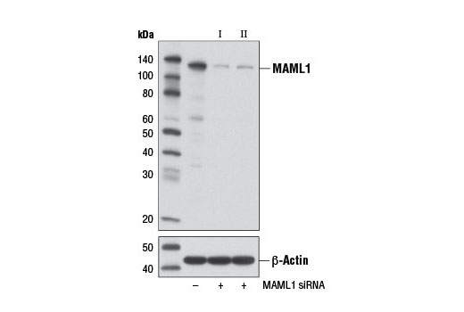 Western blot analysis of extracts from 293T cells, transfected with 100 nM SignalSilence ® Control siRNA (Unconjugated) #6568 (-), SignalSilence ® MAML1 siRNA I (+), or SignalSilence ® MAML1 siRNA II #12440 (+), using MAML1 Antibody #4608 (upper) or β-Actin (D6A8) Rabbit mAb #8457 (lower). The MAML1 Antibody confirms silencing of MAML1 expression, while the β-Actin (D6A8) Rabbit mAb is used as a loading control.