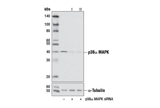 Western blot analysis of extracts from NIH/3T3 cells, transfected with 100 nM SignalSilence ® Control siRNA (Unconjugated) #6568 (-), SignalSilence ® p38α MAPK siRNA I (Mouse Specific) #6417 (+) or SignalSilence ® p38α MAPK siRNA II (Mouse Specific) (+), using p38α MAPK Antibody #9218 (upper) or α-Tubulin (11H10) Rabbit mAb #2125 (lower). The p38α MAPK Antibody confirms silencing of p38α MAPK expression, while the α-Tubulin (11H10) Rabbit mAb is used as a loading control.