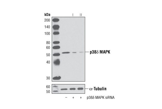 Western blot analysis of extracts from 293 cells, transfected with 100 nM SignalSilence ® Control siRNA (Unconjugated) #6568 (-), SignalSilence® p38δ MAPK siRNA I (+) or SignalSilence ® p38δ MAPK siRNA II #6601 (+), using p38δ MAPK (10A8) Rabbit mAb #2308 (upper) or α-Tubulin (11H10) Rabbit mAb #2125 (lower). The p38δ MAPK (10A8) Rabbit mAb confirms silencing of p38δ MAPK expression, while the α-Tubulin (11H10) Rabbit mAb is used as a loading control.