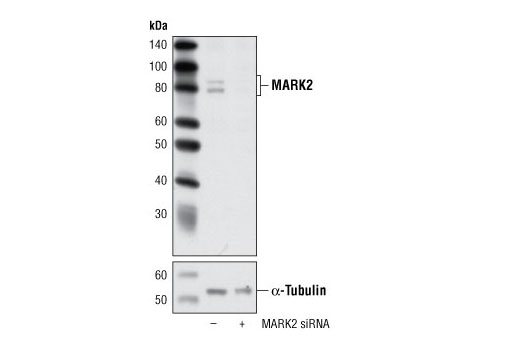 Western blot analysis of extracts from HeLa cells, transfected with 100 nM SignalSilence ® Control siRNA (Unconjugated) #6568 (-) or SignalSilence ® MARK2 siRNA I (+), using MARK2 Antibody #9118 (upper) or α-Tubulin (11H10) Rabbit mAb #2125 (lower). The MARK2 Antibody confirms silencing of MARK2 expression, while the α-Tubulin (11H10) Rabbit mAb is used as a loading control.