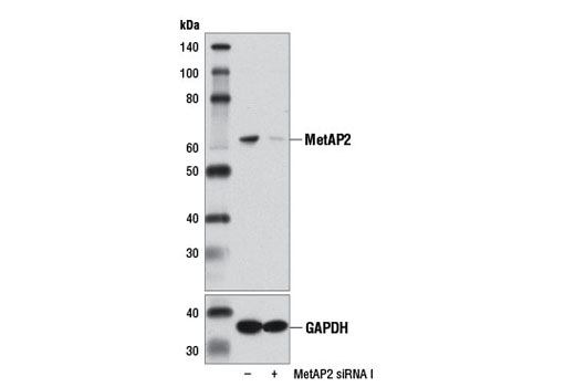 Western blot analysis of extracts from 293T cells, transfected with 100 nM SignalSilence ® Control siRNA (Unconjugated) #6568 (-) or SignalSilence ® MetAP2 siRNA I (+), using MetAP2 Antibody #11833 (upper) or GAPDH (D16H11) XP ® Rabbit mAb #5174 (lower). The MetAP2 Antibody confirms silencing of MetAP2 expression, while the GAPDH (D16H11) XP ® Rabbit mAb is used as a loading control.