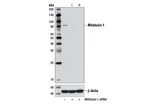 Western blot analysis of extracts from HeLa cells, transfected with SignalSilence ® Control siRNA (unconjugated) #6568 (-), SignalSilence ® Mitofusin-1 siRNA I (+) or SignalSilence ® Mitofusin-1 siRNA II #13303 (+), using Mitofusin-1 Antibody #13196 (upper) or β-Actin (D8A6) Rabbit mAb #8457 (lower). The Mitofusin-1 Antibody confirms silencing of mitofusin-1 expression, while the β-Actin (D8A6) Rabbit mAb is used as a loading control.