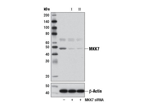 Western blot analysis of extracts from NIH/3T3 cells, transfected with 100 nM SignalSilence ® Control siRNA (Unconjugated) #6568 (-), SignalSilence ® MKK7 siRNA I (Mouse Specific) (+), or SignalSilence ® MKK7 siRNA II (Mouse Specific) #12517 (+), using MKK7 Antibody #4172 (upper) or β-Actin (D6A8) Rabbit mAb #8457 (lower). The MKK7 Antibody confirms silencing of MKK7 expression, while the β-Actin (D6A8) Rabbit mAb is used as a loading control.
