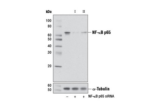 Western blot analysis of extracts from NIH/3T3 cells, transfected with 100 nM SignalSilence ® Control siRNA (Unconjugated) #6568 (-), SignalSilence ® NF-κB p65 siRNA I (Mouse Specific) #6337 (+), or SignalSilence ® NF-κB p65 siRNA II (Mouse Specific) (+), using NF-κB p65 (D14E12) XP ® Rabbit mAb #8242 (upper) or α-Tubulin (11H10) Rabbit mAb #2125 (lower). The NF-κB p65 (D14E12) XP ® Rabbit mAb confirms silencing of NF-κB p65 expression, while the α-Tubulin (11H10) Rabbit mAb is used as a loading control.