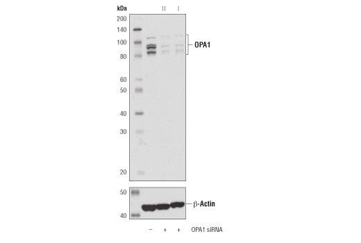 Western blot analysis of extracts from HeLa cells, transfected with 100 nM SignalSilence ® Control siRNA (Unconjugated) #6568 (-), SignalSilence ® OPA1 siRNA I (+), or SignalSilence ® OPA1 siRNA II #89128 (+) using OPA1 (D7C1A) Rabbit mAb #67589 (upper) or β-Actin (D6A8) Rabbit mAb #8457 (lower). The OPA1 (D7C1A) Rabbit mAb confirms silencing of OPA1 expression, while the β-Actin (D6A8) Rabbit mAb is used as a loading control.
