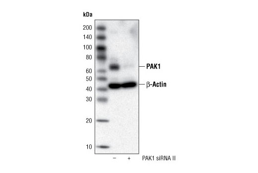 Western blot analysis of extracts from HeLa cells, transfected with 100 nM SignalSilence ® Control siRNA (Fluorescein Conjugate) #6201 (-) or SignalSilence ® PAK1 siRNA II (+), using PAK1 Antibody #2602 and α-Tubulin (11H10) Rabbit mAb #2125. The PAK1 antibody confirms silencing of PAK1 expression and α-Tubulin (11H10) Rabbit mAb is used to control for loading and specificity of PAK1 siRNA.