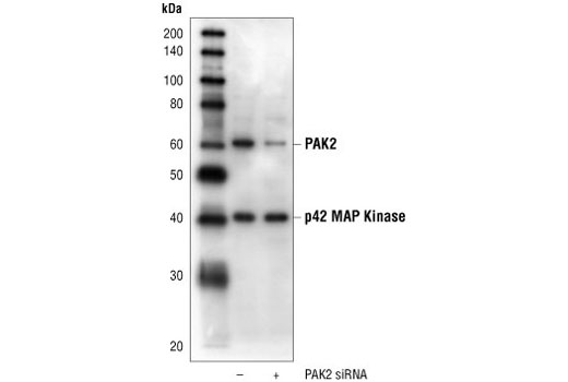 Western blot analysis of extracts from HeLa cells transfected with 100 nM control siRNA #6201 (-) or PAK2 siRNA, using PAK2 Antibody #2608 and p42 MAP Kinase (Erk2) Antibody #9108. The PAK2 Antibody confirms silencing of PAK2 expression, and p42 MAP Kinase (Erk2) Antibody is used to control for loading and specificity of PAK2 siRNA.