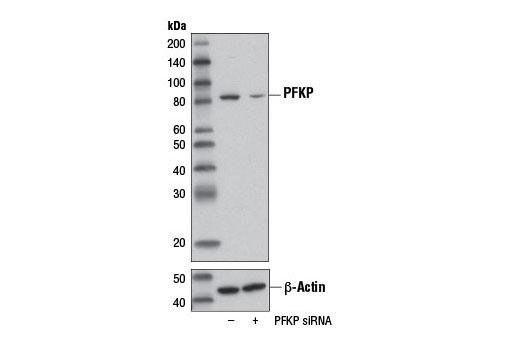 Western blot analysis of extracts from 293T cells, transfected with 100 nM SignalSilence ® Control siRNA (Unconjugated) #6568 (-) or SignalSilence ® PFKP siRNA I (+), using PFKP (D2E5) Rabbit mAb #12746 (upper) or β-Actin (D6A8) Rabbit mAb #8457 (lower). The PFKP (D2E5) Rabbit mAb confirms silencing of PFKP expression, while the β-Actin (D6A8) Rabbit mAb is used as a loading control.