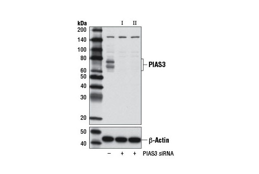 Western blot analysis of extracts from RD cells, transfected with 100 nM SignalSilence ® Control siRNA (Unconjugated) #6568 (-), SignalSilence ® PIAS3 siRNA I (+), or SignalSilence ® PIAS3 siRNA II #9031 (+), using PIAS3 (D5F9) XP ® Rabbit mAb #9042 (upper) or β-Actin (D6A8) Rabbit mAb #8457 (lower). The PIAS3 (D5F9) XP ® Rabbit mAb confirms silencing of PIAS3 expression, while the β-Actin (D6A8) Rabbit mAb is used as a loading control.