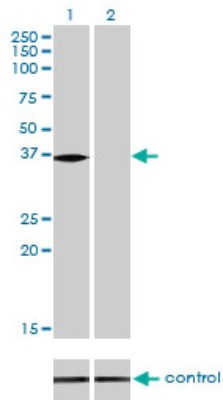 Western Blot: N myc interactor RNAi [H00009111-R01V] - Western blot analysis of NMI over-expressed 293 cell line, cotransfected with NMI Validated Chimera RNAi or non-transfected control. Blot probed with H00009111-M01. GAPDH (36.1 kDa) used as loading control.